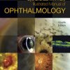The Massachusetts Eye and Ear Infirmary Illustrated Manual of Ophthalmology, 4e (Original PDF from Publisher)