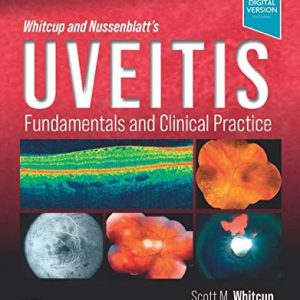 Whitcup and Nussenblatt’s Uveitis: Fundamentals and Clinical Practice, 5th edition (Original PDF from Publisher)