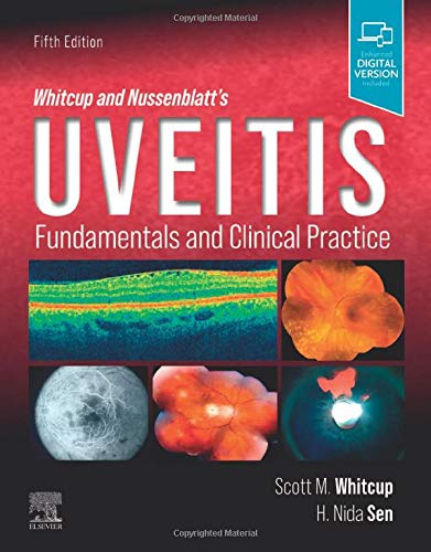Whitcup and Nussenblatt’s Uveitis: Fundamentals and Clinical Practice, 5th edition (Original PDF from Publisher)