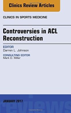 Controversies in ACL Reconstruction, An Issue of Clinics in Sports Medicine, 1e (The Clinics: Orthopedics) (PDF)