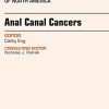 Anal Canal Cancers, An Issue of Surgical Oncology Clinics of North America, 1e (The Clinics: Surgery) (PDF)
