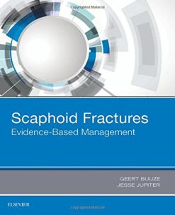 Scaphoid Fractures: Evidence-Based Management, 1e (PDF)