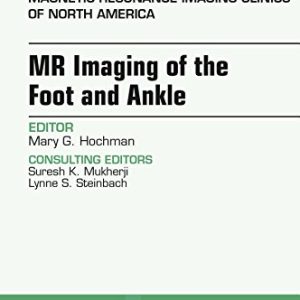 MR Imaging of the Foot and Ankle, An Issue of Magnetic Resonance Imaging Clinics of North America, 1e (The Clinics: Radiology) (PDF)