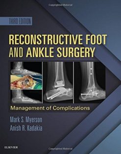 Reconstructive Foot and Ankle Surgery: Management of Complications, 3e (PDF)