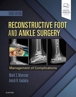 Reconstructive Foot and Ankle Surgery: Management of Complications, 3rd Edition (Videos, Organized)