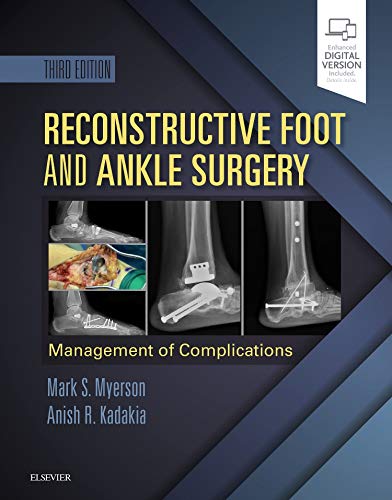 Reconstructive Foot and Ankle Surgery: Management of Complications, 3rd Edition (Videos, Organized)