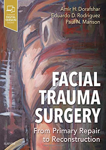 Facial Trauma Surgery: From Primary Repair to Reconstruction (Videos, Organized)