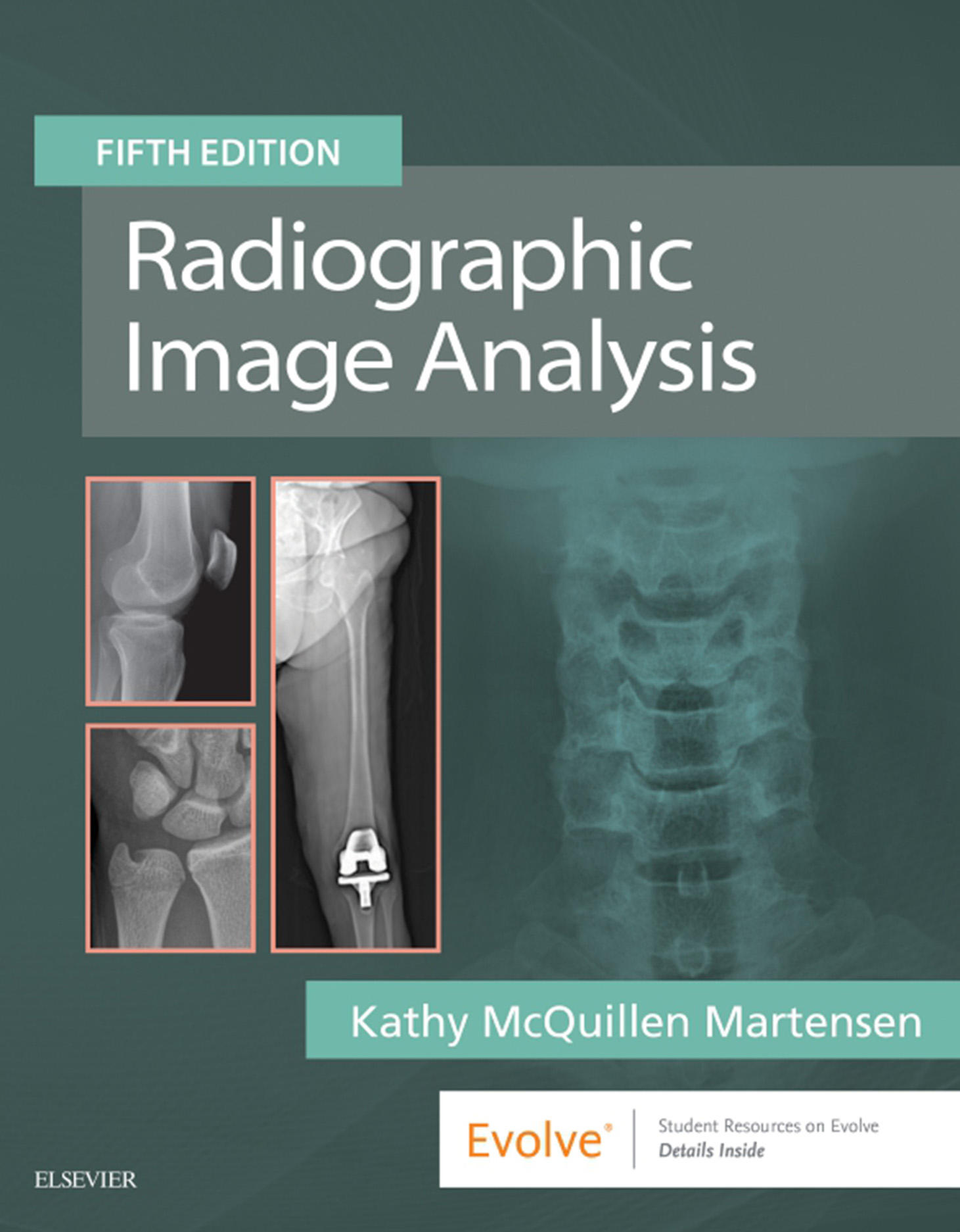 Radiographic Image Analysis, 5th Edition (EPUB)