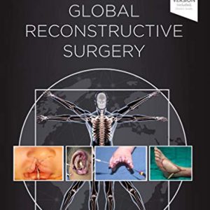 Global Reconstructive Surgery (Videos, Organized)