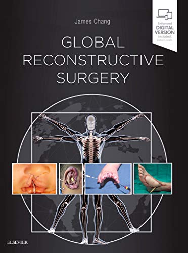 Global Reconstructive Surgery (Videos, Organized)