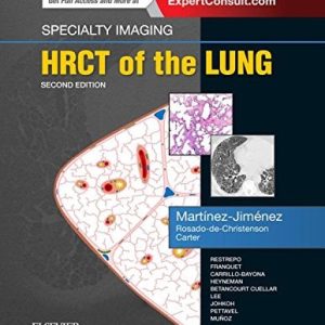 Specialty Imaging: HRCT of the Lung, 2nd Edition (EPUB)