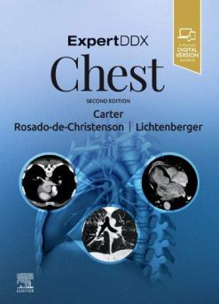 ExpertDDx: Chest, 2nd Edition (Original PDF from Publisher)