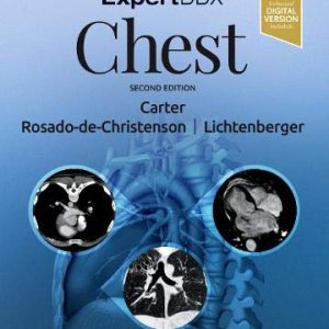 ExpertDDx: Chest, 2nd Edition (Original PDF from Publisher)