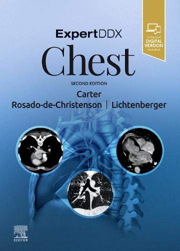 ExpertDDx: Chest, 2nd Edition (Original PDF from Publisher)