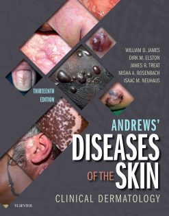 Andrews’ Diseases of the Skin: Clinical Dermatology, 13th Edition (EPUB)