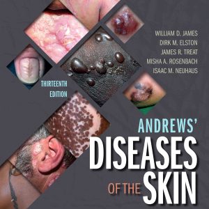 Andrews’ Diseases of the Skin: Clinical Dermatology, 13th Edition (EPUB)