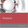Alopecia, 1e (PDF)