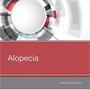 Alopecia, 1e (PDF)