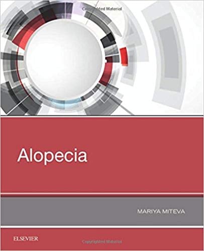 Alopecia, 1e (PDF)