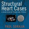 Structural Heart Cases: A Color Atlas of Pearls and Pitfalls (EPUB)