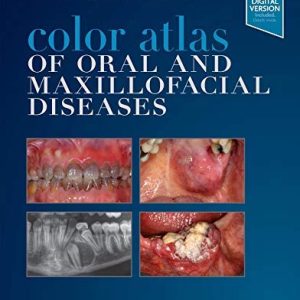 Color Atlas of Oral and Maxillofacial Diseases
