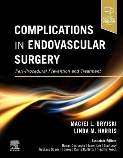 Complications in Endovascular Surgery: Peri-Procedural Prevention and Treatment (Original PDF from Publisher)