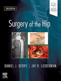 Surgery of the Hip, 2nd Edition (EPUB)