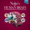 Nolte’s The Human Brain in Photographs and Diagrams, 5th edition (Original PDF from Publisher)