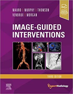 Image-Guided Interventions: Expert Radiology Series, 3rd Edition (True PDF + ToC + Index)