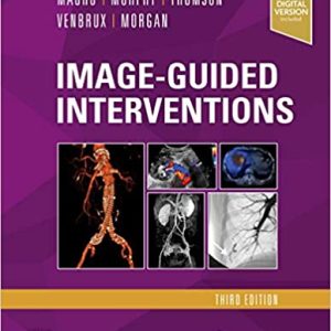 Image-Guided Interventions: Expert Radiology Series, 3rd Edition (True PDF + ToC + Index)