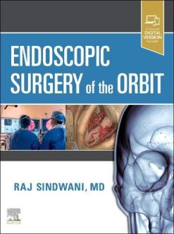 Endoscopic Surgery of the Orbit (Original PDF from Publisher)