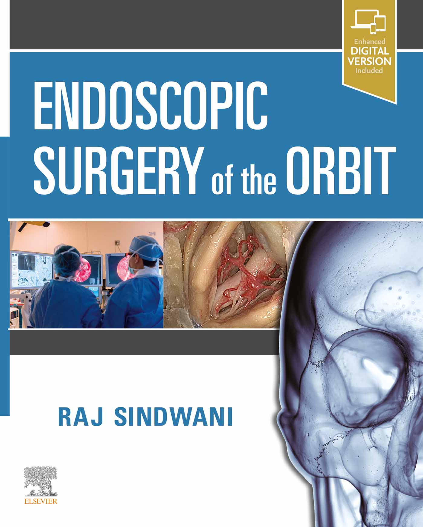Endoscopic Surgery of the Orbit (EPUB)