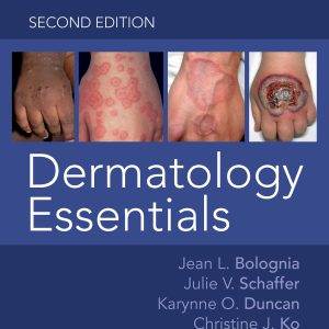 Dermatology Essentials, 2nd Edition (EPUB)