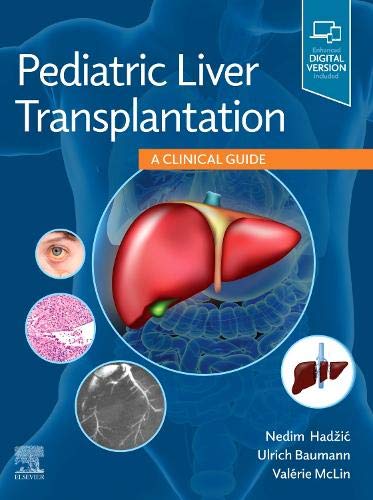 Pediatric Liver Transplantation: A Clinical Guide (True PDF with ToC & Index)