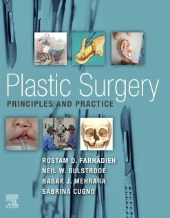 Plastic Surgery – Principles and Practice (EPUB)