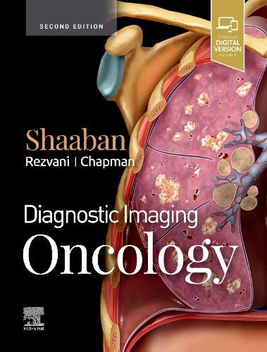 Diagnostic Imaging: Oncology, 2nd Edition (Original PDF from Publisher)