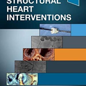 Handbook of Structural Heart Interventions (Videos Only, Well Organized)