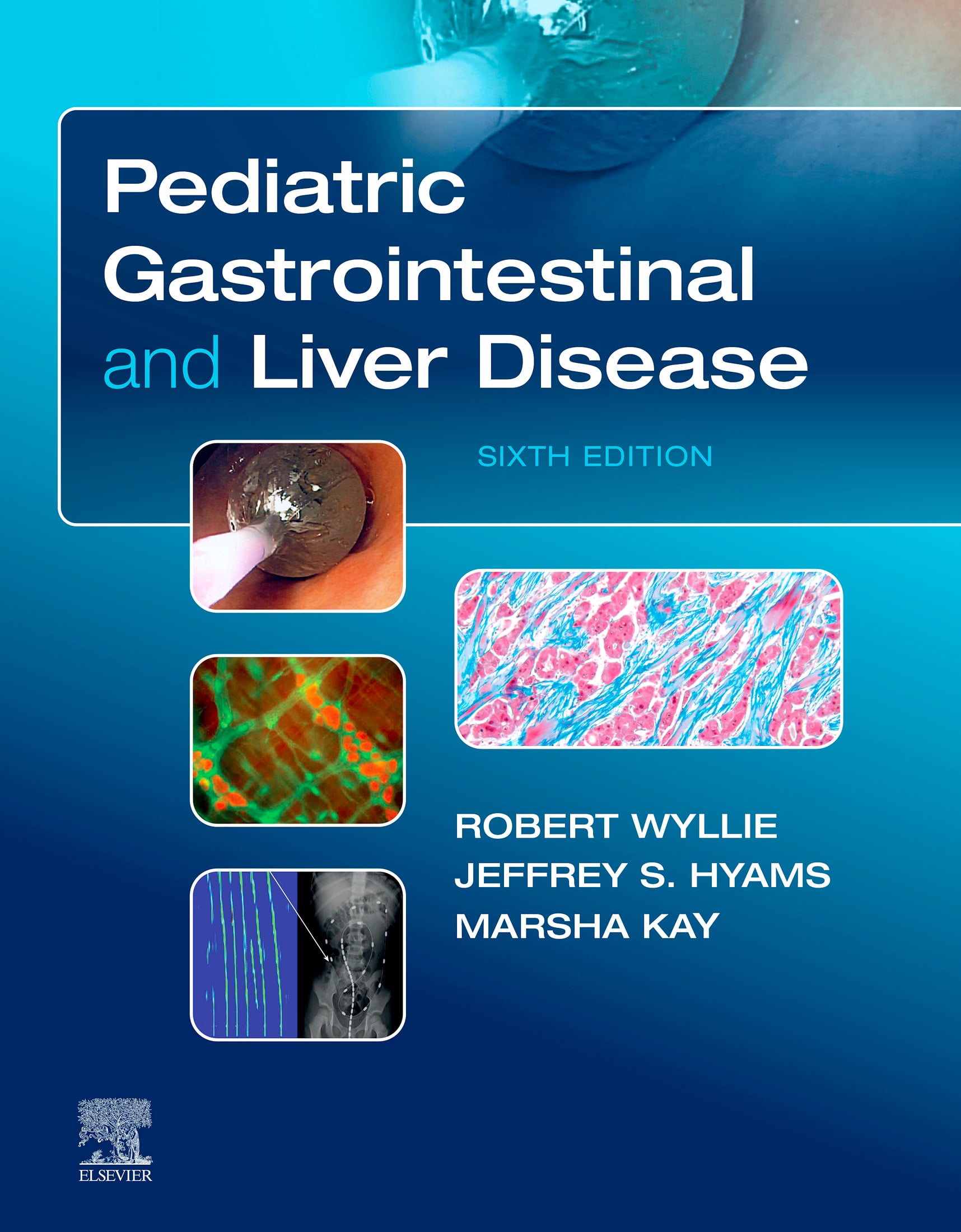 Pediatric Gastrointestinal and Liver Disease, 6th Edition (EPUB)
