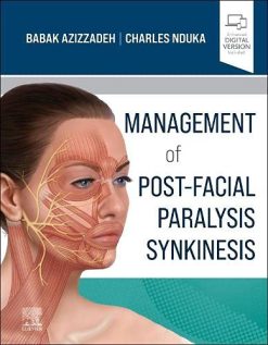 Management of Post-Facial Paralysis Synkinesis (Original PDF from Publisher)