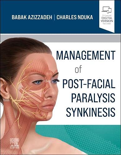 Management of Post-Facial Paralysis Synkinesis (Original PDF from Publisher)