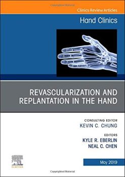 Revascularization and Replantation in the Hand, An Issue of Hand Clinics (Volume 35-2) (The Clinics: Orthopedics, Volume 35-2) (Original PDF from Publisher)