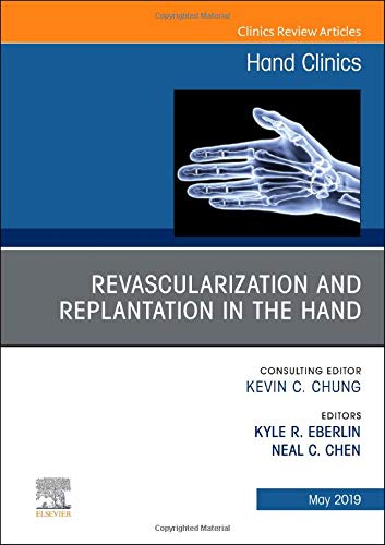 Revascularization and Replantation in the Hand, An Issue of Hand Clinics (Volume 35-2) (The Clinics: Orthopedics, Volume 35-2) (Original PDF from Publisher)