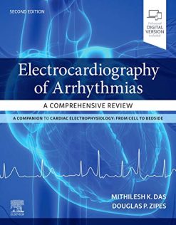 Electrocardiography of Arrhythmias: A Comprehensive Review: A Companion to Cardiac Electrophysiology, 2nd Edition (Original PDF from Publisher)