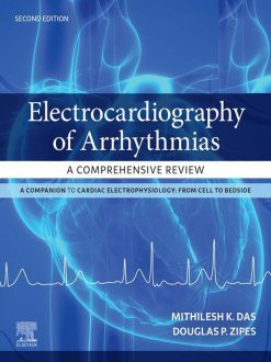Electrocardiography of Arrhythmias: A Comprehensive Review: A Companion to Cardiac Electrophysiology, 2nd Edition (EPUB)