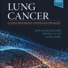 Lung Cancer: An Evidence-Based Approach to Multidisciplinary Management (EPUB)