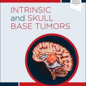 Intrinsic and Skull Base Tumors: Neurosurgery: Case Management Comparison Series (Original PDF from Publisher)