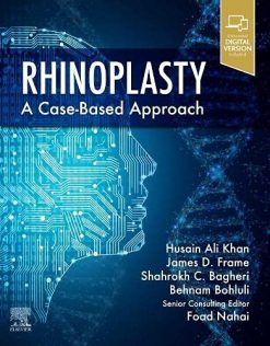 Rhinoplasty: a Case-based approach (Original PDF from Publisher)