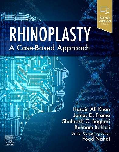 Rhinoplasty: a Case-based approach (Original PDF from Publisher)