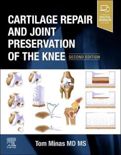 Cartilage Repair and Joint Preservation of the Knee, 2nd Edition (Original PDF from Publisher)