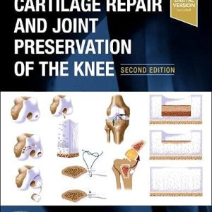 Cartilage Repair and Joint Preservation of the Knee, 2nd Edition (Original PDF from Publisher)